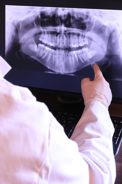 Best Chipped Tooth Repair Near Me  in Sergeant Bluff, IA